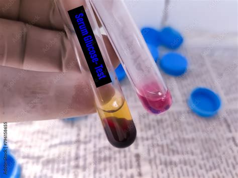 Image result for Creatinine Lab Testing