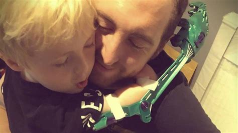 3D-printing dad makes bike for children missing limbs - BBC News