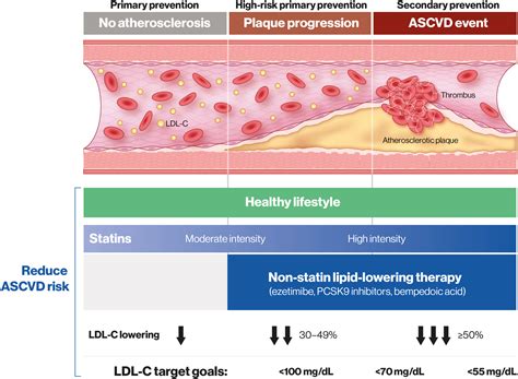 Evolving Management of Low‐Density Lipoprotein Cholesterol: A Personalized Approach to ...