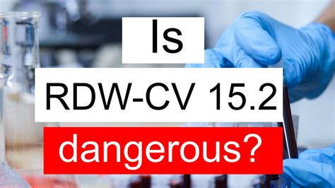 Is RDW CV 15.2 high, normal or dangerous? What does RDW CV level 15.2 mean?