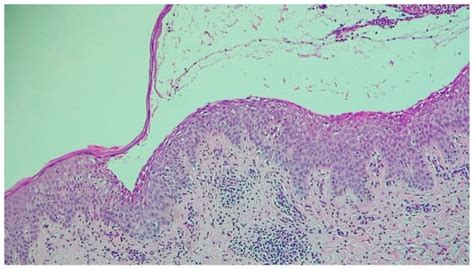 Dermato | An Open Access Journal from MDPI