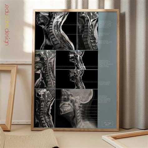 Patología Cervical » educare.design