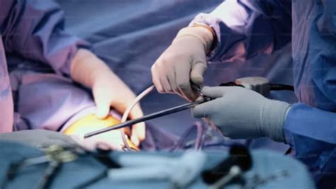 Switch Procedure 的图像结果