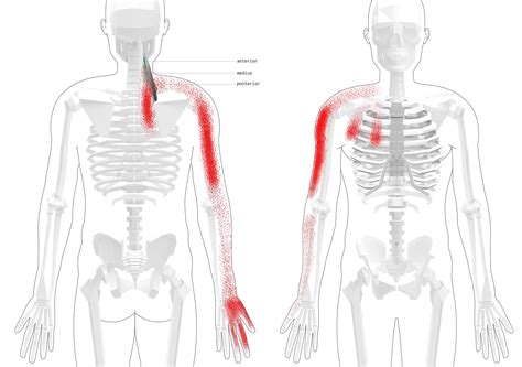 Upper Back Trigger Points (Overview + Tips and Exercises)