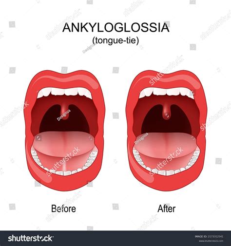 266 Before And After Teeth Pain Images, Stock Photos & Vectors | Shutterstock