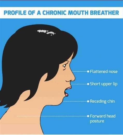 Mouth breathing has a major influence on the shape of your skull and face. There is truth to ...