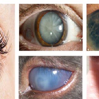 Image result for Iris Recognition Using MATLAB Source Code
