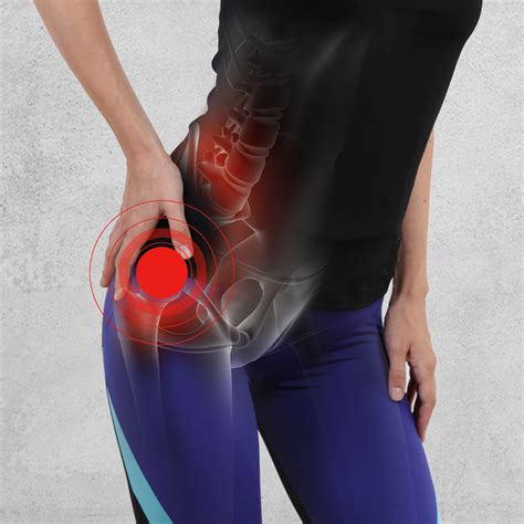 Snapping Hip Syndrome | Orthopedics Sports Medicine