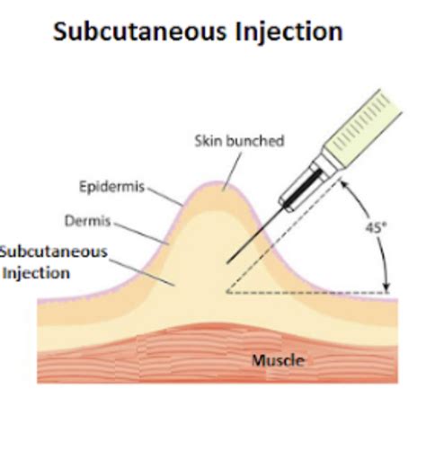 Image result for Subcut Injection OSCE