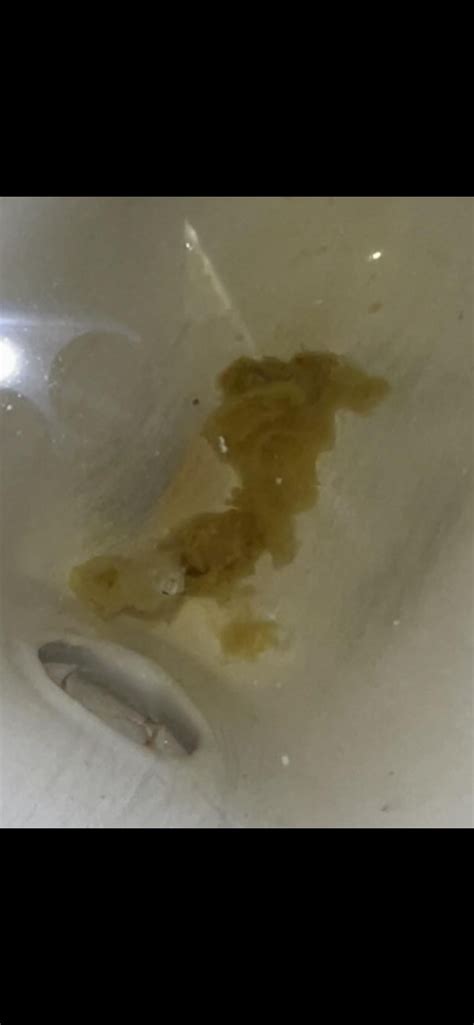 What is this fluffy white stuff? : r/poop