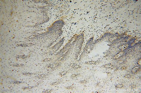 ARHGDIB antibody (16122-1-AP) | Proteintech