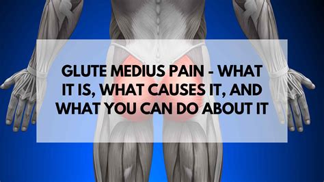 Gluteus Medius Pain