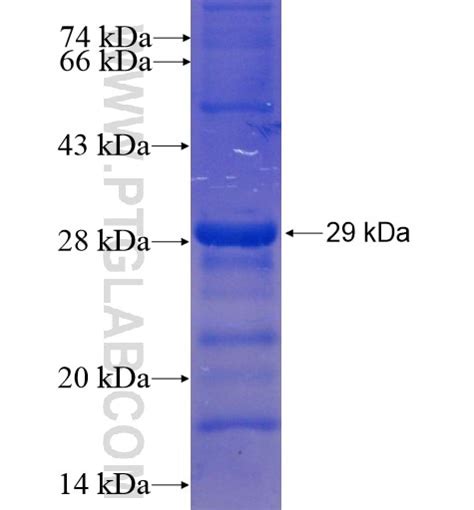 VEGFB Fusion Protein Ag13063 | Proteintech