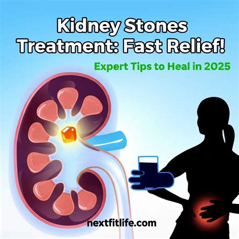 Kidney Stones Treatment 2025: Fast Relief Experts Trust