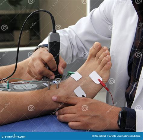 Somatosensory Evoked Potentials SEP or Nerve Conduction Velocity NCV is a Test of Electrical ...