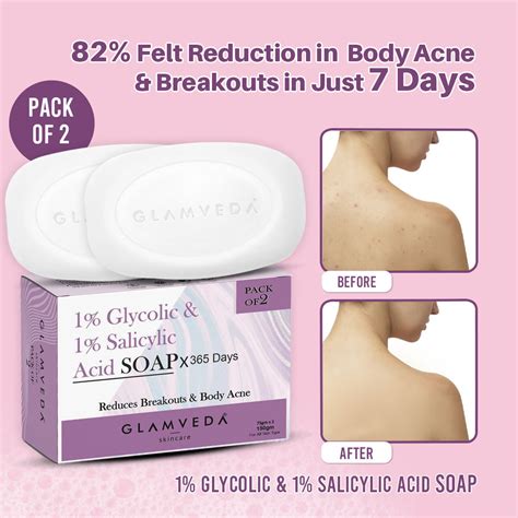 Glamveda 1% Glycolic Acid & 1% ww Salicylic Acid Body Acne Soap ...