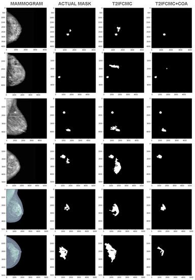 Chimp Optimization Algorithm Influenced Type-2 Intuitionistic Fuzzy C ...