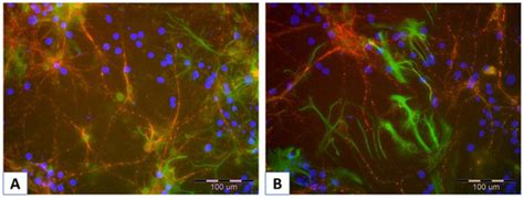 Emerging Approaches to Mitigate Neural Cell Degeneration with ...