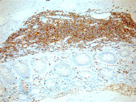 Image result for Faces CD3