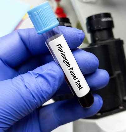 Image result for Fibrinogen Test Procedure