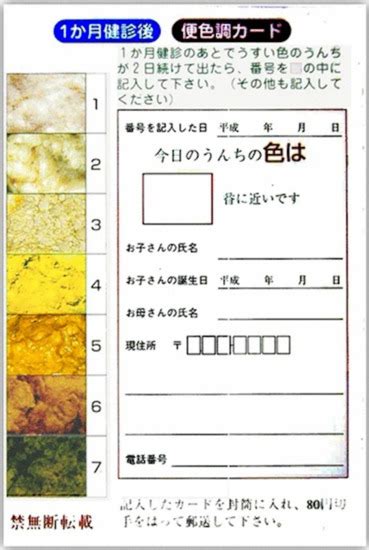 JCM | Special Issue : Biliary Atresia: Aetiology, Diagnosis and Treatment