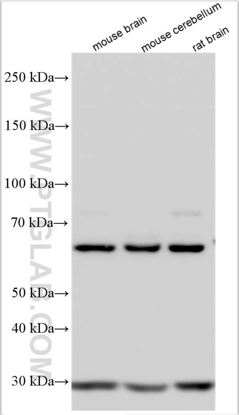 SKOR2 antibody (55370-1-AP) | Proteintech