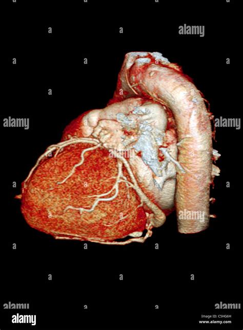 3d ct scan human heart hi-res stock photography and images - Alamy