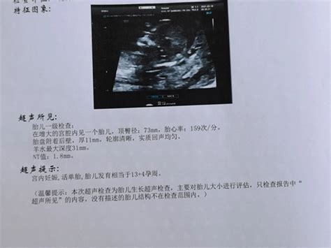 孕12周/28周两次男孩最后翻盘了，b超数据看性别准确率太渣了 - WCOB