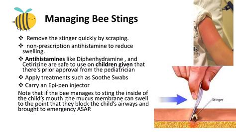 Icd 10 Bee Sting