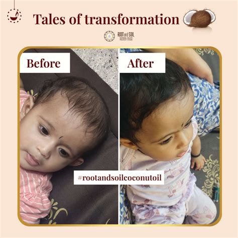 Best Baby Hair Oil - Coconut Hair Oil for Newborns – ROOT and SOIL