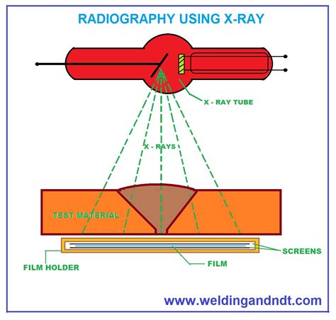 How Does Digital Radiography Work