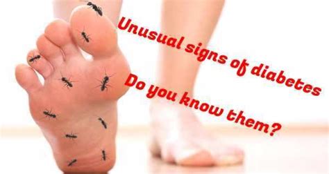 5 unusual signs of diabetes you should watch out for! | TheHealthSite ...