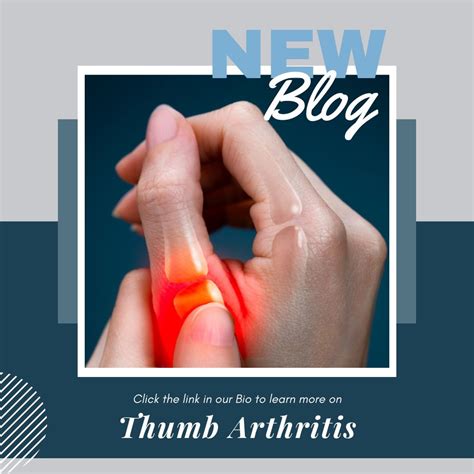 Joints Of Thumb Arthritis Of The Thumb | Bauerfeind New Zealand