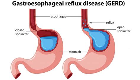 Is Late-Night Eating Bad For You? | FITPASS