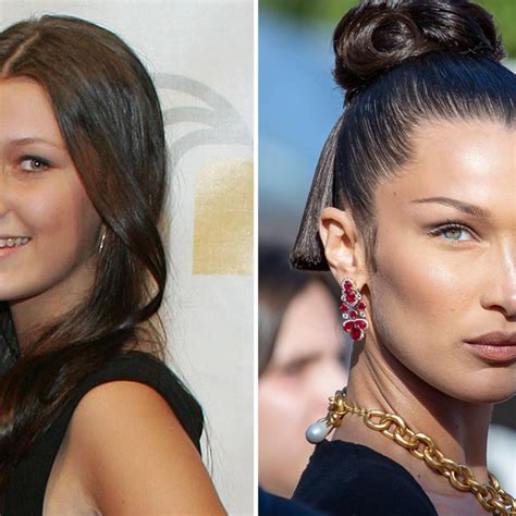 Bella Hadid Before Plastic Surgery