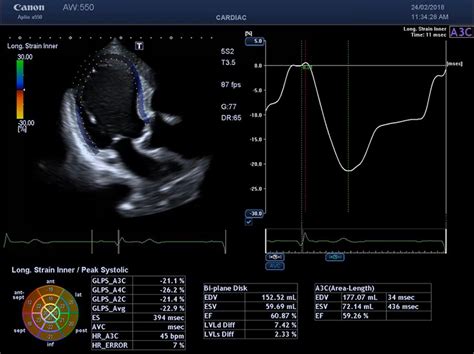 Canon Aplio i700 купити в Україні | InMed