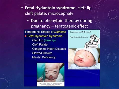 Anti-epileptic drugs | PPTX
