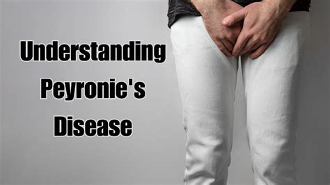 Peyronie's Disease Treatment - Reproductive Health