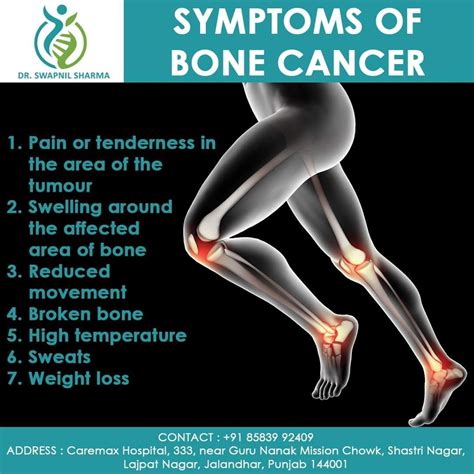 Bone cancer – Artofit