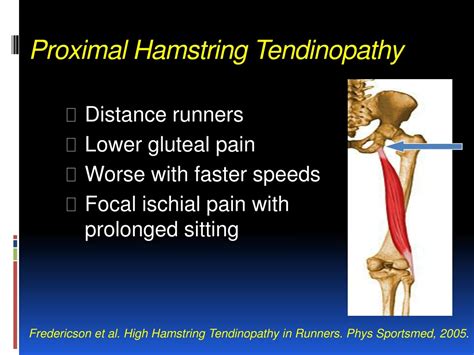 PPT - Buttock Pain in Athletes: Case Examples & Management Strategies ...