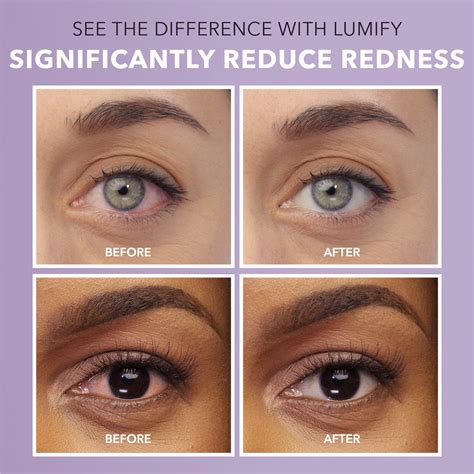 Buy LUMIFY® Redness Reliever Eye Drops 7.5mL