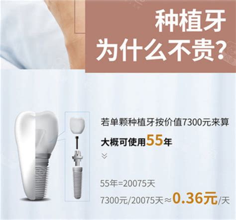 种植牙多少钱一颗2023价格表发布，含单颗/半口/全口收费,种植牙-8682赴韩整形网