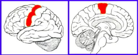 Image result for Contralateral Weakness