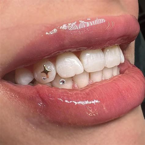 Image result for DIY Tooth Gems