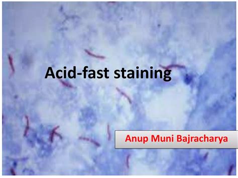 Image result for Acid-Fast Staining Method