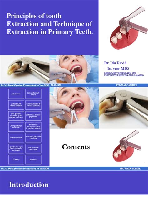 Image result for Basic Tooth Extraction