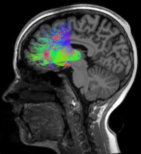 Image result for fMRI Python