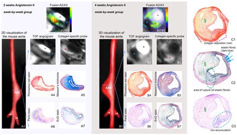 Targeting the Extracellular Matrix in Abdominal Aortic Aneurysms Using ...
