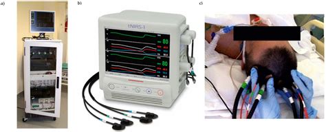 Clinical Brain Monitoring with Time Domain NIRS: A Review and Future ...