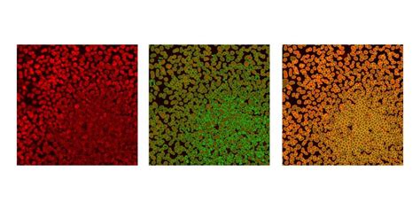 Image result for Deep Learning Algorithm for Image Analysis